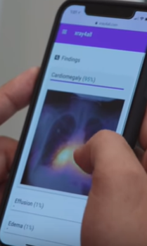 Chest X-ray classification app